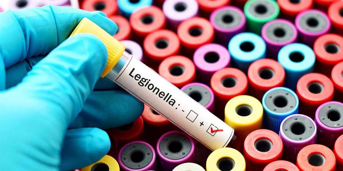 Why legionella management could be a new area of massive importance